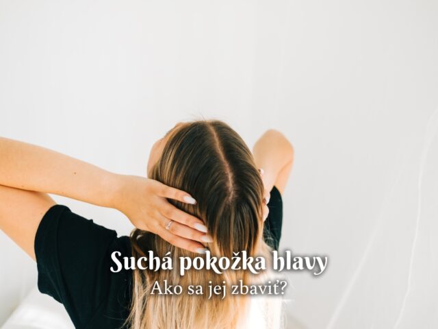 suchá pokožka hlavy